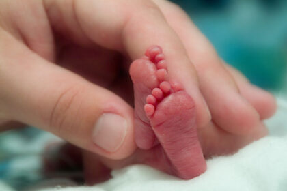 La transfusión de sangre de cordón umbilical mejora la evolución de prematuros extremos