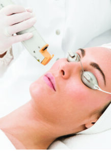 El láser dermatológico revoluciona el tratamiento de manchas y cicatrices en la piel