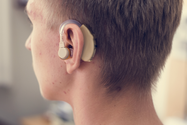 Del Silencio a la Vida: Cómo los Implantes Cocleares Transforman Historias en República Dominicana