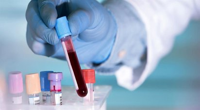 Nuevo análisis de sangre podría detectar el Alzheimer años antes de los síntomas
