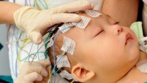 Día Mundial del Síndrome de West: llamado urgente a la detección temprana y mayor apoyo a las familias