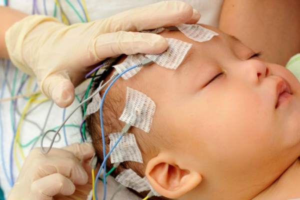 Día Mundial del Síndrome de West: llamado urgente a la detección temprana y mayor apoyo a las familias