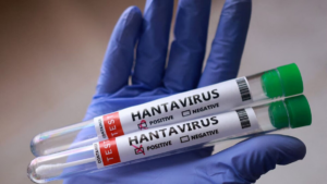 Canadá eleva a seis los aislados por riesgo de hantavirus tras posible exposición en vuelos