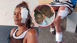 Joven madre denuncia ataque a machetazos y puñaladas en Santiago por su expareja