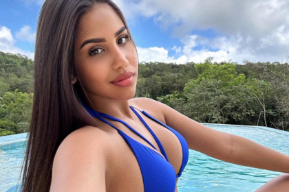Oriana Falla revela mala práctica estética que afectó su rostro: “No vuelvo a inventar con mi cara”